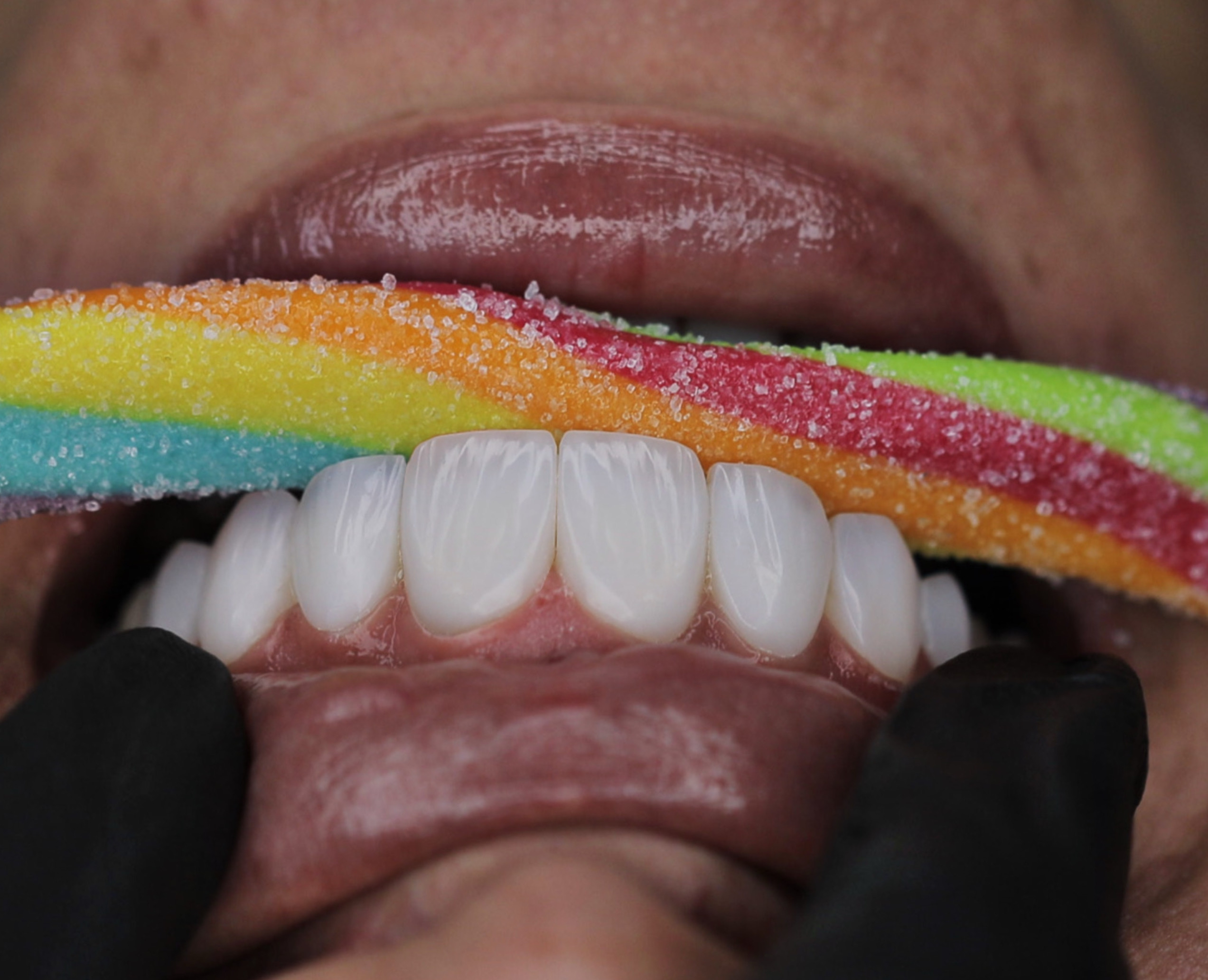 ونیرکامپوزیت